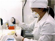 Bóng đá anh, ngoại hạng anh, lịch thi đấu euro 2012, Dịch HIV/AIDS có sự thay đổi về phân bố giới tính