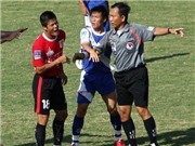 Bóng đá anh, ngoại hạng anh, lịch thi đấu euro 2012, K.Khánh Hòa: Xấu xí phô ra