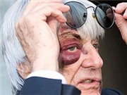 Bóng đá anh, ngoại hạng anh, lịch thi đấu euro 2012, “Ông trùm” làng F1 bị cướp tấn công