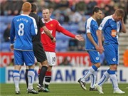 Bóng đá anh, ngoại hạng anh, lịch thi đấu euro 2012, Rooney với nguy cơ bị lỡ trận đại chiến với Chelsea