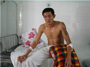 Bóng đá anh, ngoại hạng anh, lịch thi đấu euro 2012, Vụ cầu thủ Trần Chí Công bị chém: CQĐT đang khẩn trương truy bắt nhóm hung thủ