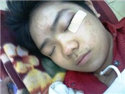Bóng đá anh, ngoại hạng anh, lịch thi đấu euro 2012, Luật sư vào cuộc vụ HS bị đánh trong tiệc chia tay