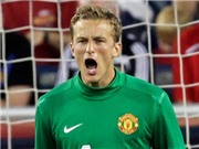 Bóng đá anh, ngoại hạng anh, lịch thi đấu euro 2012, Thủ môn Lindegaard quyết "chiến" vì suất số 1 ở M.U