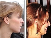 Bóng đá anh, ngoại hạng anh, lịch thi đấu euro 2012, Nhà Rooney: Coleen lây bệnh hói của chồng