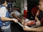 Bóng đá anh, ngoại hạng anh, lịch thi đấu euro 2012, Philippines: 454 người bị thương do pháo, đạn lạc