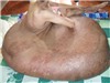 Bóng đá anh, ngoại hạng anh, lịch thi đấu euro 2012, Sáng nay, bóc “chân voi” 90 kg cho anh Hải