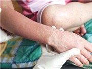 Bóng đá anh, ngoại hạng anh, lịch thi đấu euro 2012, Tết rượu bia nhiều có thể bị dị ứng