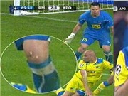 Bóng đá anh, ngoại hạng anh, lịch thi đấu euro 2012, Cầu thủ APOEL mất cặp răng vì Ronaldo