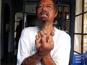 Bóng đá anh, ngoại hạng anh, lịch thi đấu euro 2012, Ngày về của “cậu bé napalm”
